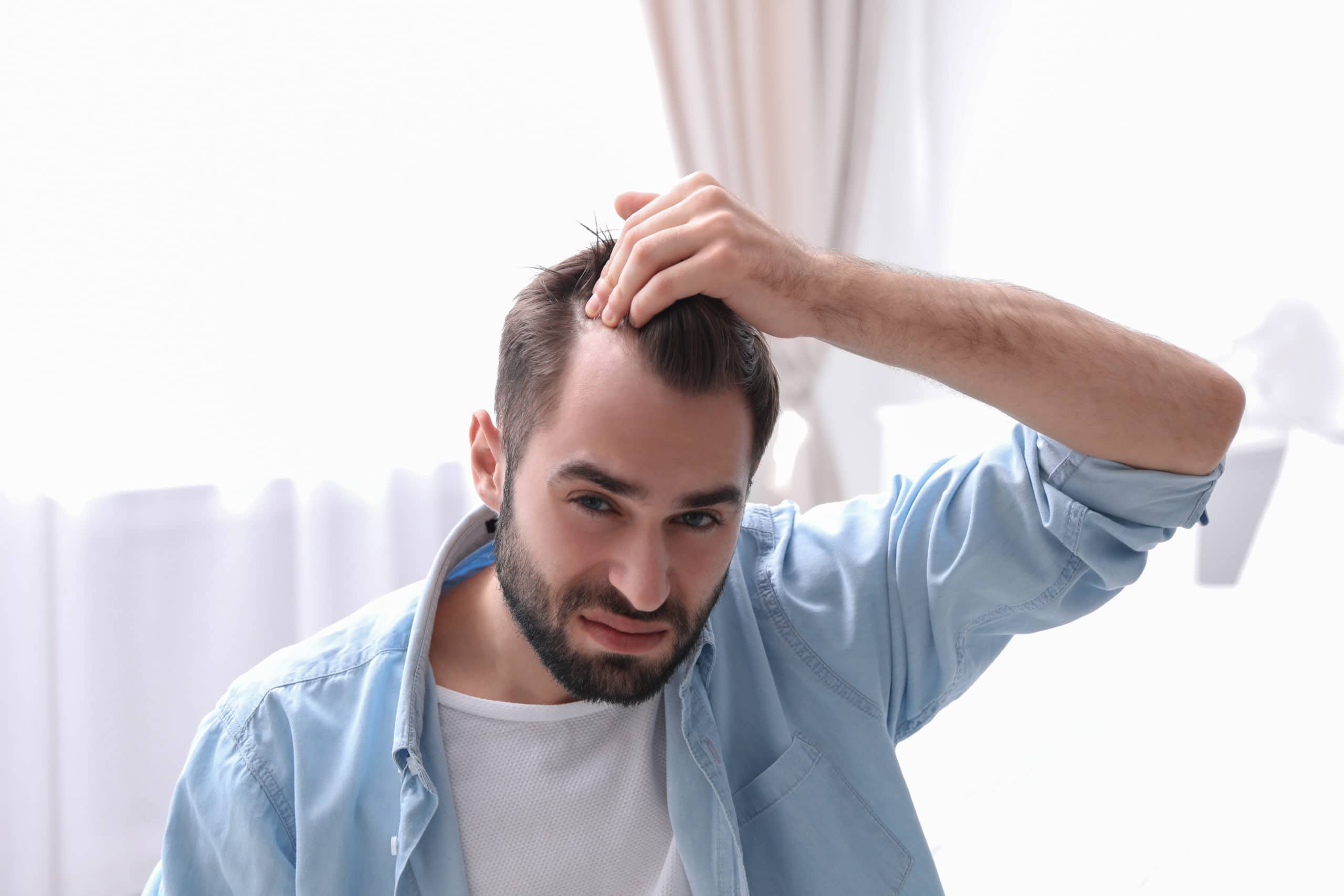 Beyond Baldness: The Modern Man’s Guide to Hair Transplants