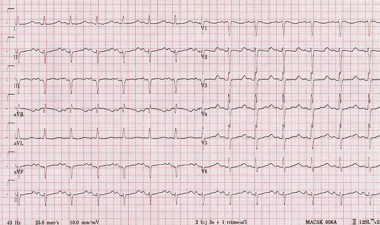 EKG Practice Test: Fine-Tuning Interpretation Precision